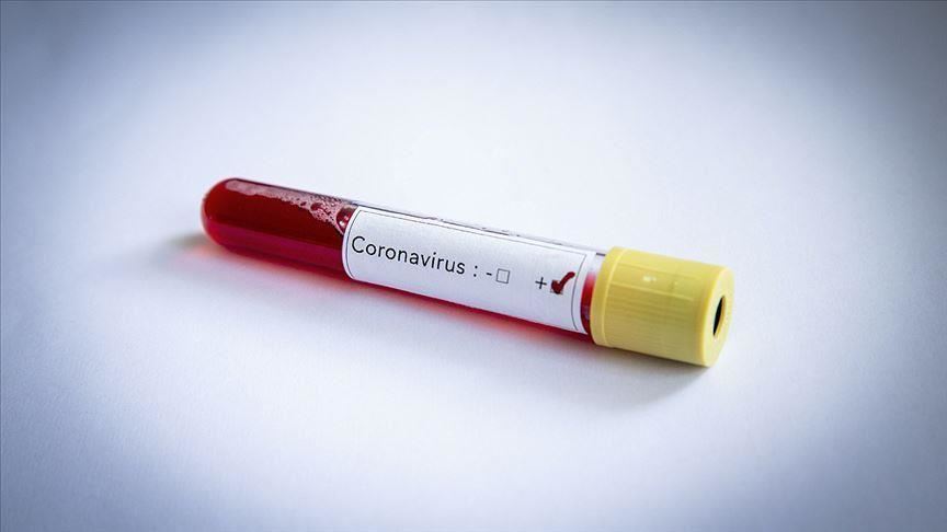 28-дневна карантина за заразени с коронавирус