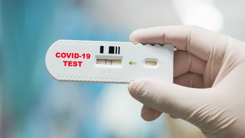 Австрия ще изисква при влизане  от българските граждани PCR или антигенен тест за коронавирус