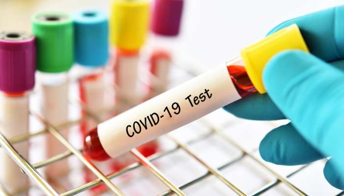 Изискване за отрицателен PCR тест при започване на работа